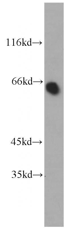 mouse kidney tissue were subjected to SDS PAGE followed by western blot with Catalog No:113645(PDZK1 antibody) at dilution of 1:500