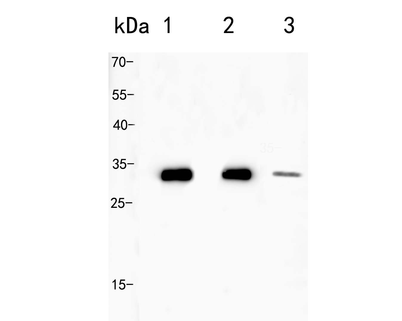 Fig2:; Western blot analysis of Osteopontin on different lysates. Proteins were transferred to a PVDF membrane and blocked with 5% BSA in PBS for 1 hour at room temperature. The primary antibody ( 1/2000) was used in 5% BSA at room temperature for 2 hours. Goat Anti-Rabbit IgG - HRP Secondary Antibody (HA1001) at 1:5,000 dilution was used for 1 hour at room temperature.; Positive control:; Lane 1: Rat kidney tissue lysate; Lane 2: Mouse kidney tissue lysate; Lane 3: HepG2 cell lysate