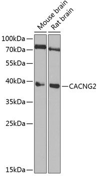 Western blot - CACNG2 Polyclonal Antibody 