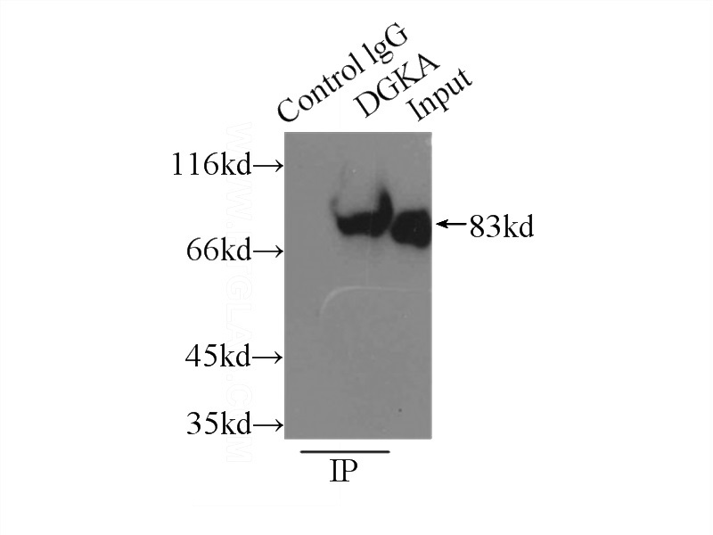 IP Result of anti-DGKA (IP:Catalog No:109909, 3ug; Detection:Catalog No:109909 1:1000) with Jurkat cells lysate 1500ug.