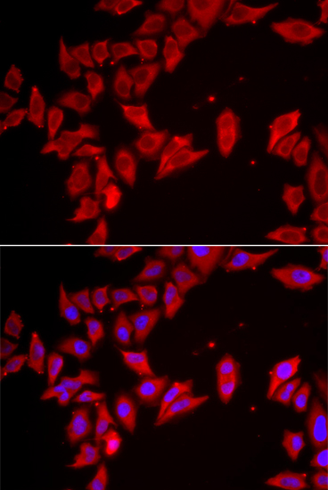 Immunofluorescence - SLC35A2 Polyclonal Antibody 