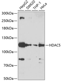 Western blot - HDAC5 Polyclonal Antibody 