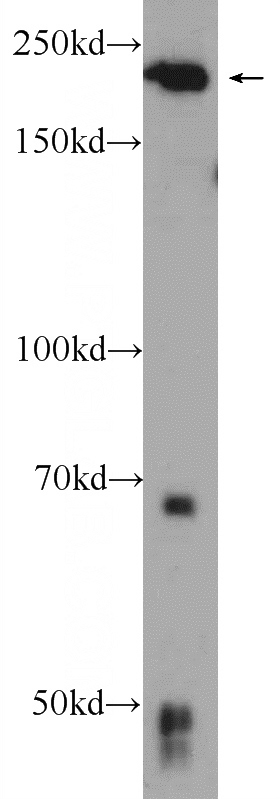 COLO 320 cells were subjected to SDS PAGE followed by western blot with Catalog No:110045(DocK6 Antibody) at dilution of 1:300