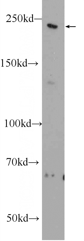 rat brain tissue were subjected to SDS PAGE followed by western blot with Catalog No:112979(MYO16 Antibody) at dilution of 1:1000