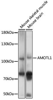 Western blot - AMOTL1 Polyclonal Antibody 