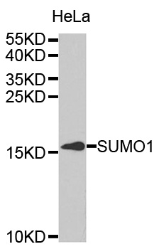Western blot analysis of extracts of HeLa cell line, using SUMO1 antibody.