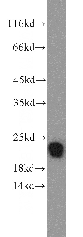 mouse pancreas tissue were subjected to SDS PAGE followed by western blot with Catalog No:116273(TMED10 antibody) at dilution of 1:1000