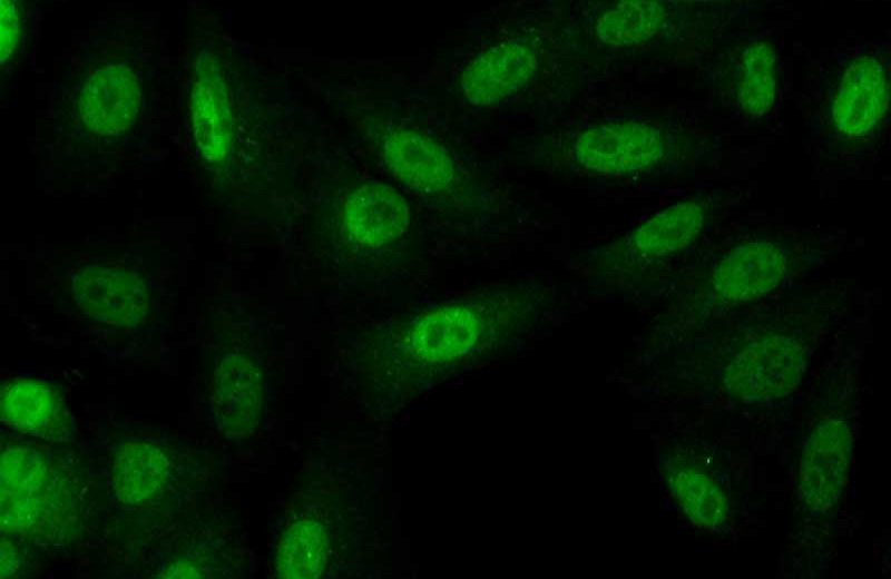 Immunofluorescent analysis of (10% Formaldehyde) fixed A549 cells using Catalog No:112114(KPNA4 Antibody) at dilution of 1:50 and Alexa Fluor 488-congugated AffiniPure Goat Anti-Rabbit IgG(H+L)