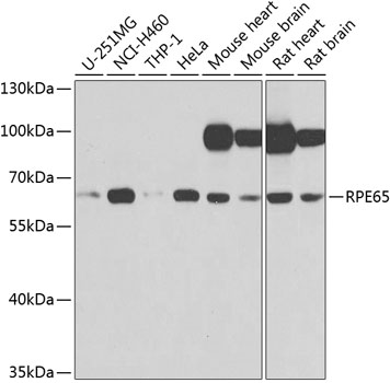 Western blot - RPE65 Polyclonal Antibody 
