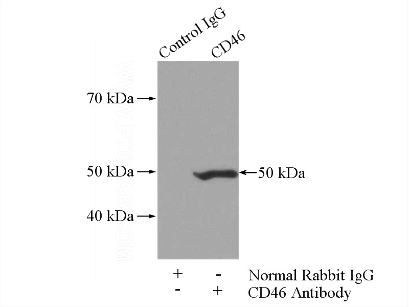 IP Result of anti-CD46 (IP:Catalog No:109126, 4ug; Detection:Catalog No:109126 1:1000) with A549 cells lysate 1800ug.