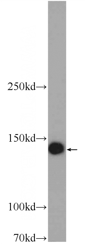 HeLa cells were subjected to SDS PAGE followed by western blot with Catalog No:116383(TTC37 Antibody) at dilution of 1:300