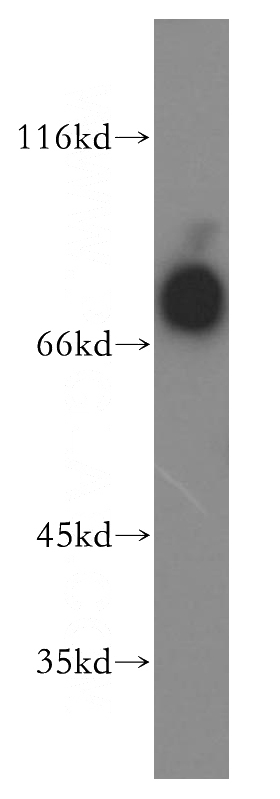 HL-60 cells were subjected to SDS PAGE followed by western blot with Catalog No:111744(IL3RA antibody) at dilution of 1:300
