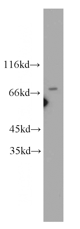 MCF7 cells were subjected to SDS PAGE followed by western blot with Catalog No:114576(SNHG3-RCC1 antibody) at dilution of 1:300