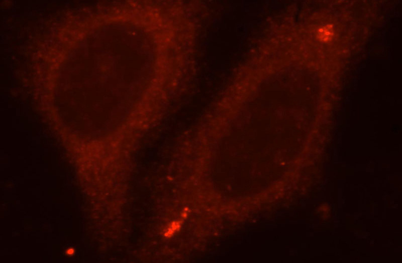 Immunofluorescent analysis of HepG2 cells, using TBCC antibody Catalog No:115871 at 1:25 dilution and Rhodamine-labeled goat anti-rabbit IgG (red).