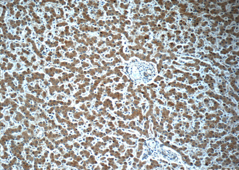 Immunohistochemistry of paraffin-embedded human liver slide using Catalog No:112036(KHDC1 Antibody) at dilution of 1:50 (under 10x lens)