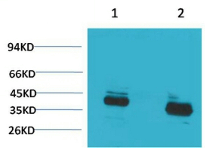 Fig1:; Western blot analysis of 1) Mouse Brain Tissue, 2) Rat Brain Tissue with CABP Rabbit pAb diluted at 1:2,000.