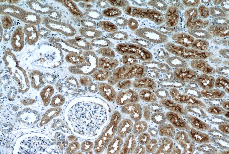 Immunohistochemistry of paraffin-embedded human kidney tissue slide using Catalog No:115169(SLC5A2 Antibody) at dilution of 1:200 (under 10x lens)