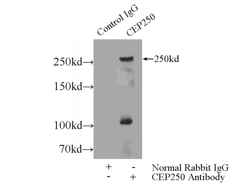 IP Result of anti-CEP250,C-NAP1 (IP:Catalog No:109270, 5ug; Detection:Catalog No:109270 1:500) with HeLa cells lysate 1200ug.