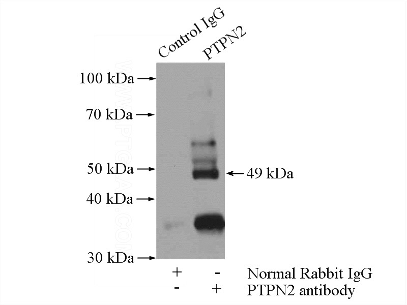 IP Result of anti-PTPN2 (IP:Catalog No:114318, 4ug; Detection:Catalog No:114318 1:500) with HL-60 cells lysate 4000ug.