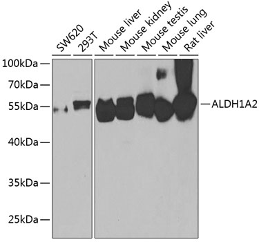 Western blot - ALDH1A2 Polyclonal Antibody 