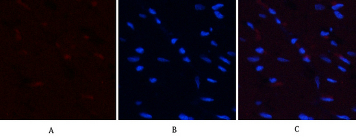 Immunofluorescence analysis of rat-heart tissue. 1,PI 3-kinase p85α (phospho Tyr607) Polyclonal Antibody(red) was diluted at 1:200(4°C,overnight). 2, Cy3 labled Secondary antibody was diluted at 1:300(room temperature, 50min).3, Picture B: DAPI(blue) 10min. Picture A:Target. Picture B: DAPI. Picture C: merge of A+B
