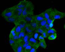 Fig1: Immunocytochemical staining of Hela cells using anti-CCL3 rabbit polyclonal antibody.