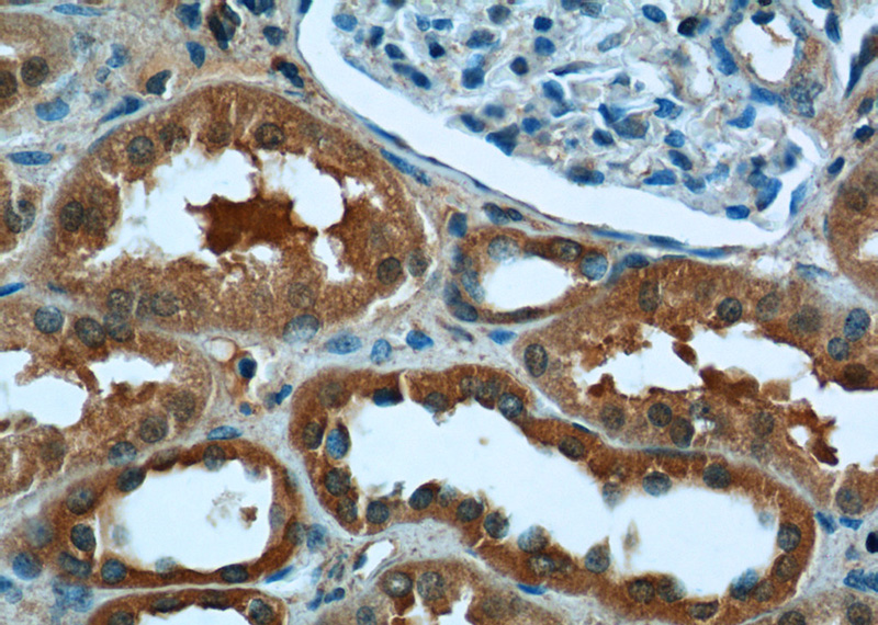 Immunohistochemistry of paraffin-embedded human kidney tissue slide using Catalog No:109680(CYP11B2 Antibody) at dilution of 1:50 (under 40x lens)