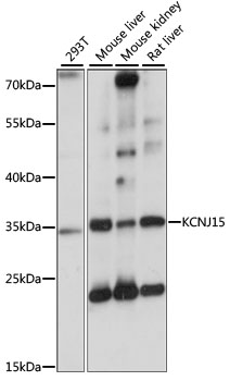 Western blot - KCNJ15 Polyclonal Antibody 