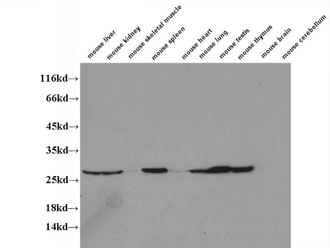 WB results of Catalog No:114026(PMM2 antibody) on several lysates.