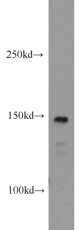 Jurkat cells were subjected to SDS PAGE followed by western blot with Catalog No:109606(CSPP1 antibody) at dilution of 1:200