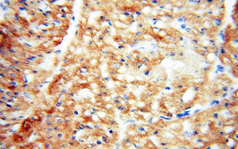 Immunohistochemical of paraffin-embedded human heart using Catalog No:116148(TNNC1 antibody) at dilution of 1:50 (under 40x lens)