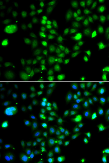 Immunofluorescence - PRDM5 Polyclonal Antibody 