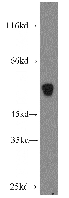A375 cells were subjected to SDS PAGE followed by western blot with Catalog No:116553(UGCG antibody) at dilution of 1:1000
