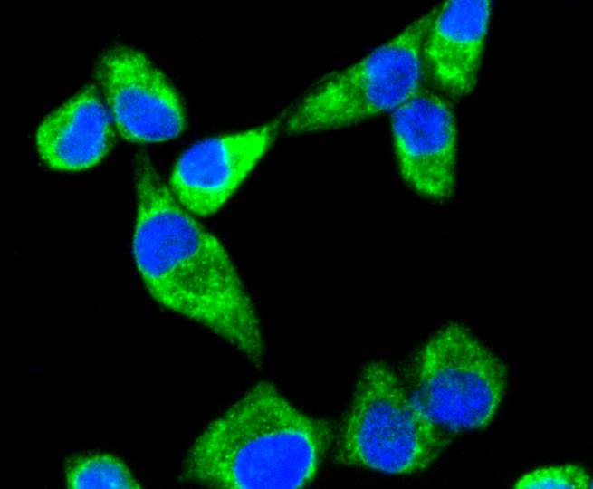 Fig2:; ICC staining Sonic Hedgehog Protein in Hela cells (green). The nuclear counter stain is DAPI (blue). Cells were fixed in paraformaldehyde, permeabilised with 0.25% Triton X100/PBS.