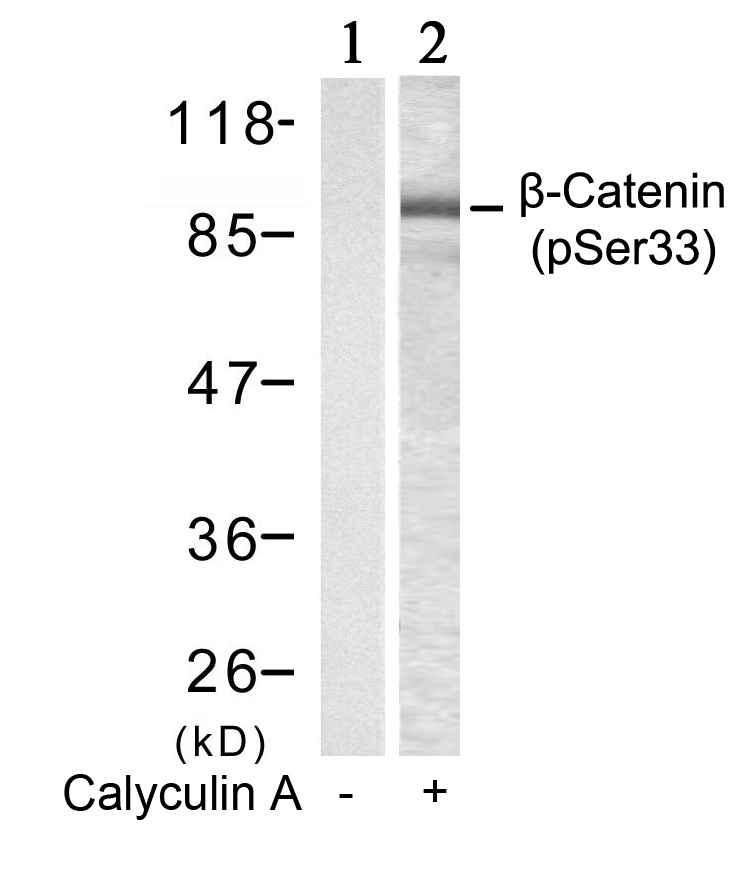 Western blot analysis of extracts from MCF-7 cells untreated or treated with Calyculin A using u03b2-Catenin (Phospho-Ser33) Antibody .