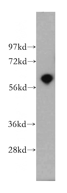 human brain tissue were subjected to SDS PAGE followed by western blot with Catalog No:113657(PDE1A antibody) at dilution of 1:500
