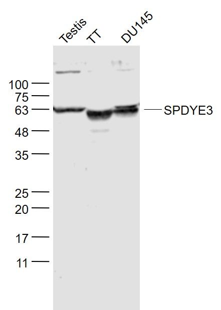 Fig1: Sample:; Testis (Mouse) Lysate at 40 ug; TT(Human) Cell Lysate at 30 ug; DU145(Human) Cell Lysate at 30 ug; Primary: Anti- SPDYE3 at 1/300 dilution; Secondary: IRDye800CW Goat Anti-Rabbit IgG at 1/20000 dilution; Predicted band size: 64 kD; Observed band size: 64 kD