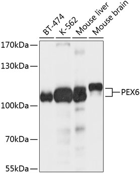 Western blot - PEX6 Polyclonal Antibody 