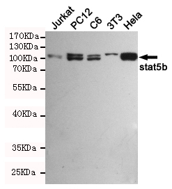 Western blot detection of stat5b in Jurkat,PC-12,C6,3T3 and Hela cell lysates using stat5b mouse mAb (1:1000 diluted).Predicted band size:90KDa.Observed band size:90KDa.