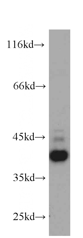 HeLa cells were subjected to SDS PAGE followed by western blot with Catalog No:107186(CXCR3B antibody) at dilution of 1:1000