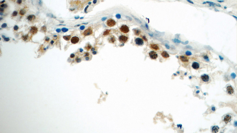 Immunohistochemistry of paraffin-embedded human testis tissue slide using Catalog No:107587(SIRT1 Antibody) at dilution of 1:50 (under 40x lens)