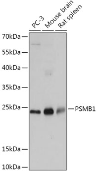Western blot - PSMB1 Polyclonal Antibody 