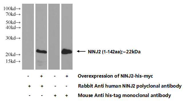 Transfected HEK-293 cells were subjected to SDS PAGE followed by western blot with Catalog No:113185(NINJ2 Antibody) at dilution of 1:1000