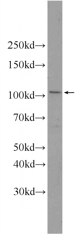 HepG2 cells were subjected to SDS PAGE followed by western blot with Catalog No:112275(LAMP1 Antibody) at dilution of 1:500