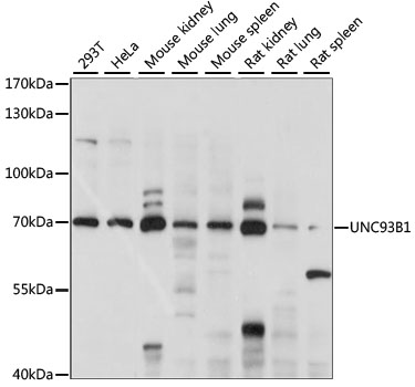 Western blot - UNC93B1 Polyclonal Antibody 