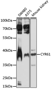 Western blot - CYR61 Polyclonal Antibody 