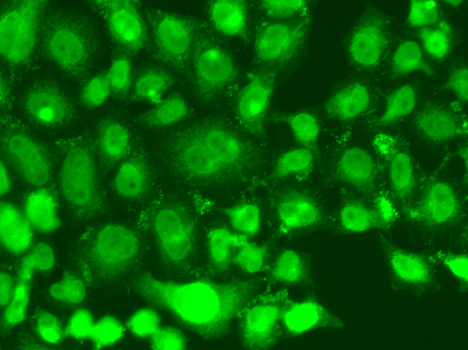 Immunofluorescence - TSEN2 Polyclonal Antibody 