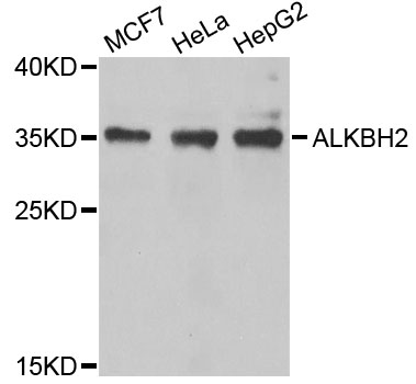 Western blot - ALKBH2 Polyclonal Antibody 