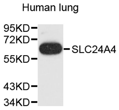 Western blot - SLC24A4 Polyclonal Antibody 