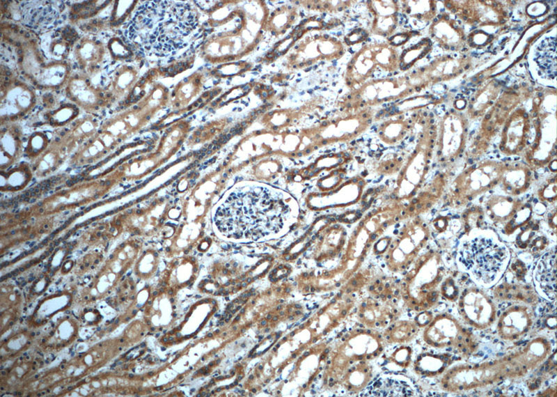 Immunohistochemistry of paraffin-embedded human kidney slide using Catalog No:112602(MGME1 Antibody) at dilution of 1:50 (under 10x lens)